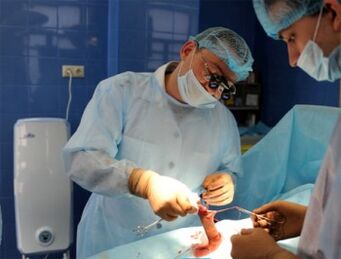 Operatie de marire a penisului efectuata de chirurgi